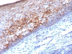 MCAM/CD146 Antibody (MCAM/1101), Novus Biologicals 0.2mg; Unlabeled:Antibodies,
